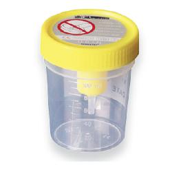 CONTENITORE URINA STERILE MEDIPRESTERIL CON SISTEMA TRANSFERT PER PROVETTE SOTTOVUOTO - Farmamood